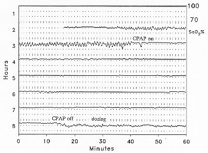 Figure 5b