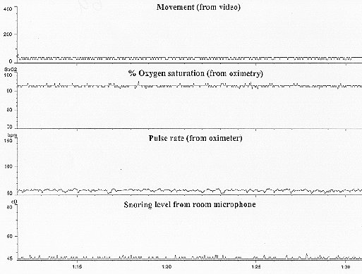 Figure 6a