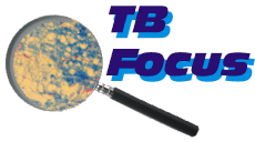TB Focus Logo 