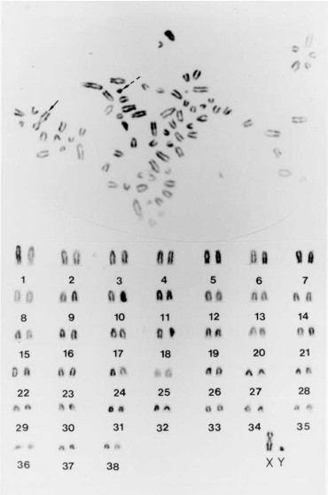 Karyotype and mitotic metaphase chromosomes